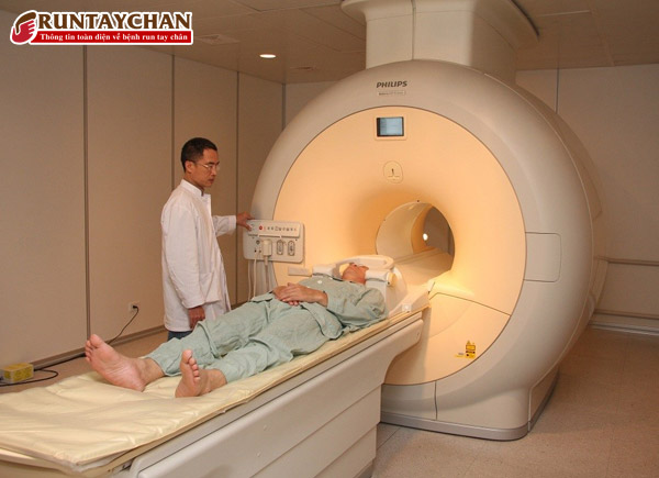 Chụp MRI của sẽ giúp chẩn đoán hội chứng Parkinson mạch máu sau tai biến